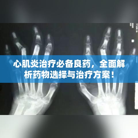 心肌炎治療必備良藥，全面解析藥物選擇與治療方案！
