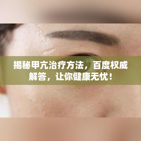 揭秘甲亢治療方法，百度權(quán)威解答，讓你健康無憂！