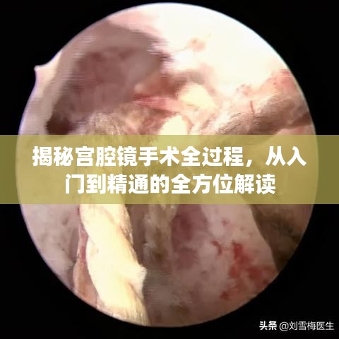 揭秘宮腔鏡手術全過程，從入門到精通的全方位解讀