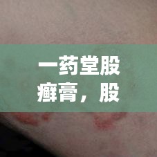 一藥堂股癬膏，股癬的克星，專業(yè)解決方案